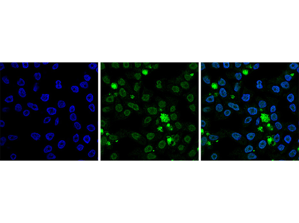 Immunofluorescence using Anti-Histone H2B pan